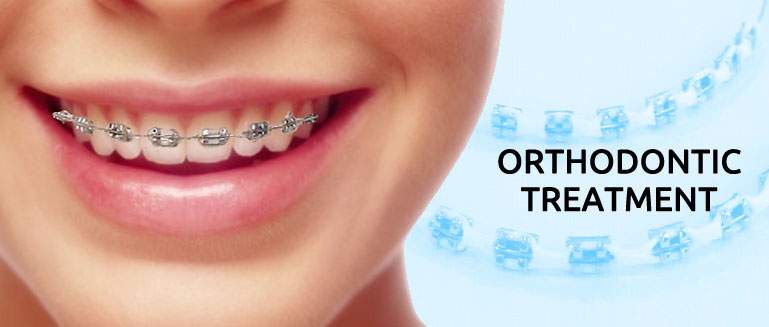 Reasons to Visit Orthodontist