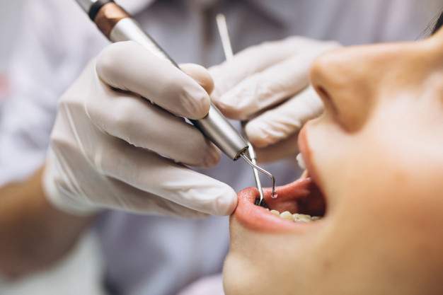 Tooth Removal