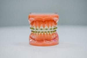 braces albany