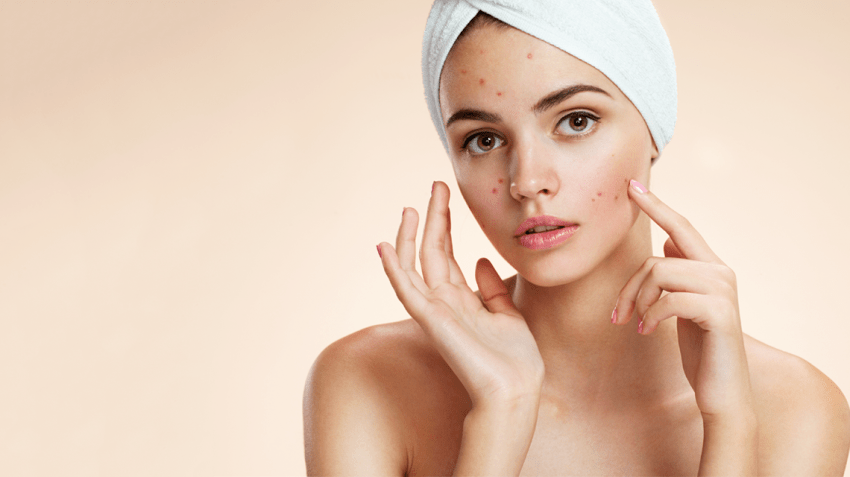 Rid Of Black Spots Skin